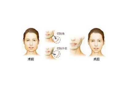 廣西醫(yī)科大學附屬第一醫(yī)院整形科,專家坐診時間