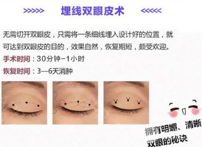 指南|廣西醫科大整形美容科醫生名單,pick雙眼皮大咖