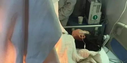 廣西2歲女孩掉進開水盆 全身56 燒傷 還一度出現休克