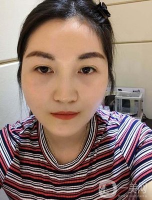 廣西醫科大一附院整形科正頜案例