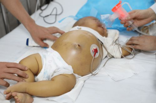 廣西醫(yī)科大學(xué)第一附屬醫(yī)院器官移植科正式成立