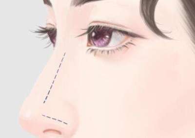 廣州藝美李闖怎么樣?真人案例分析,盤點(diǎn)醫(yī)院咨詢